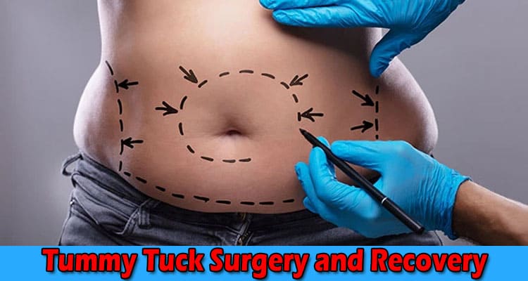 Achieving Abdominal Transformation – Everything to Know About the Tummy Tuck Surgery and Recovery