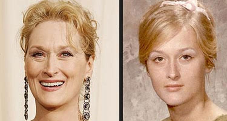 Latest News Has Mery Streep Had Plastic Surgery